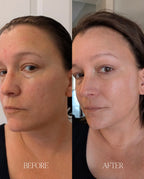 Avara Face Bundle Moisturizer and Spray