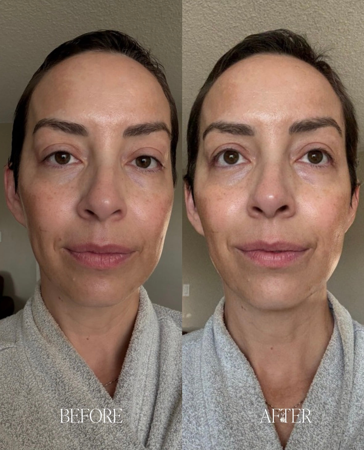 Avara Barrier Repair Trio